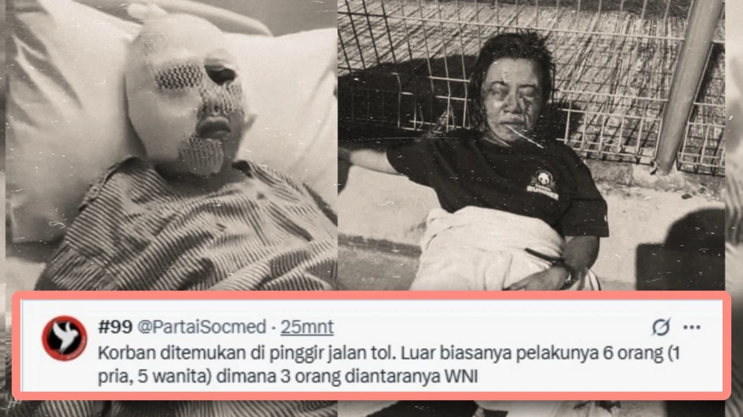 “Diah Ayu Disiksa di Negeri Orang: Biaya Rumah Sakit Ditanggung Uya Kuya, Solidaritas di Tengah Luka”